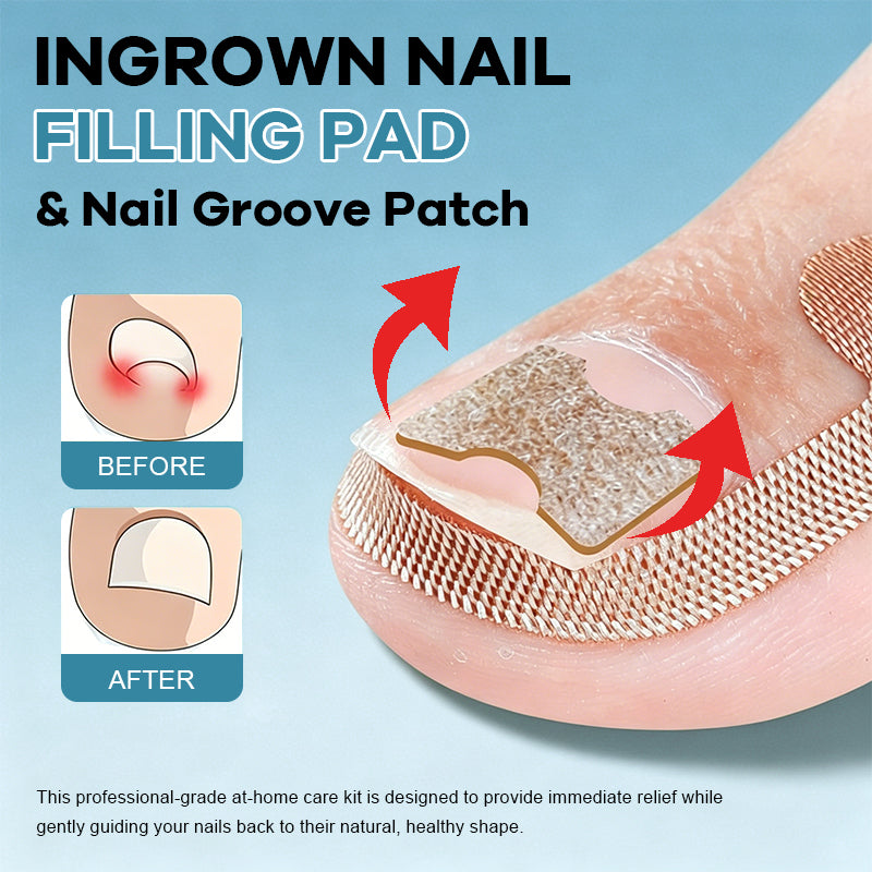 Ingrown Nail Filling Pad & Nail Groove Patch
