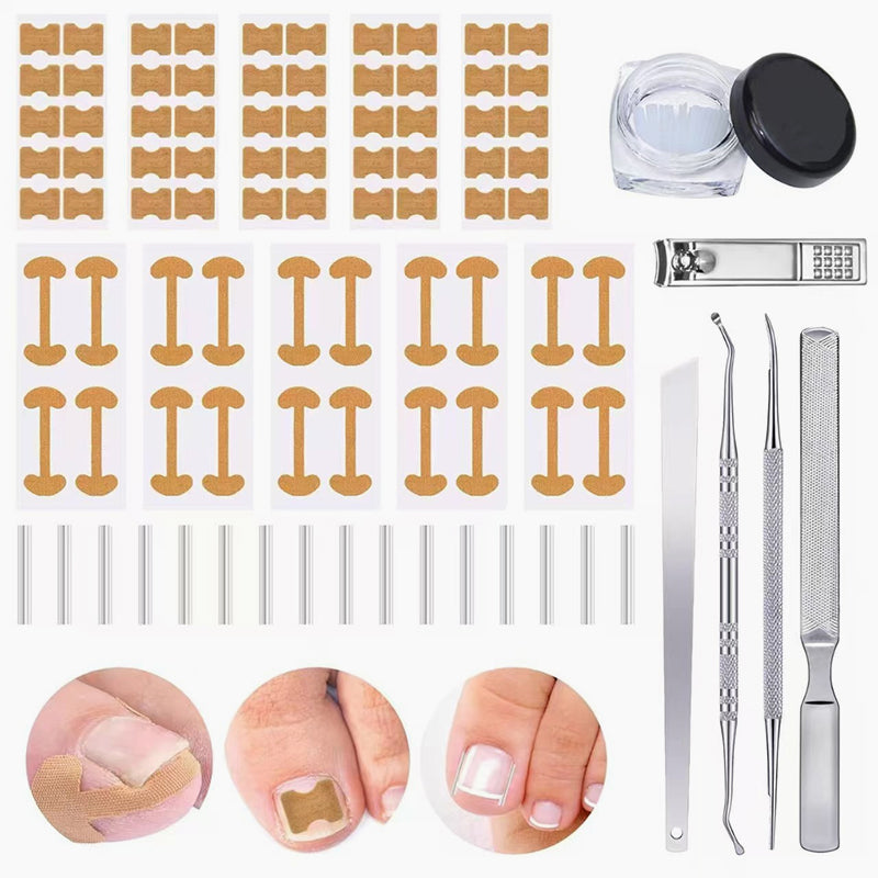 Ingrown Nail Filling Pad & Nail Groove Patch